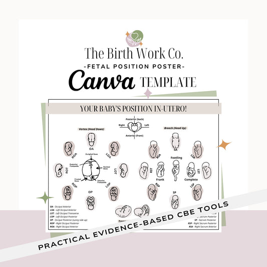 Fetal Positioning Birth Doula Poster | Birth Doula Handout | Childbirth Education | Doula Templates